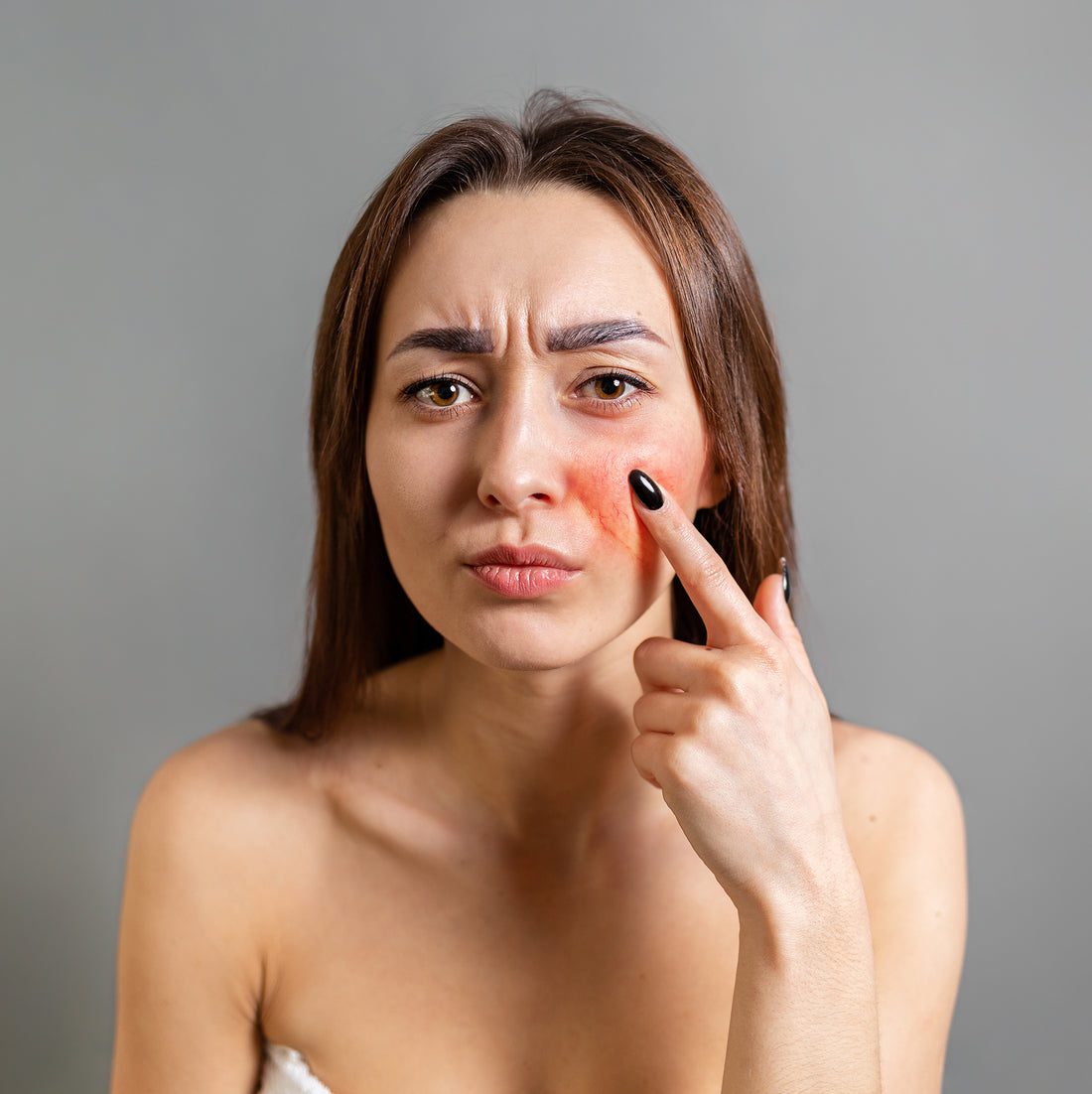 Sensitive vs. Sensitized Skin